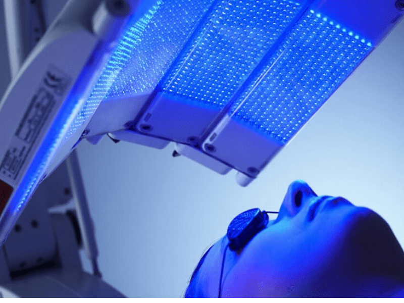 Blue Light Therapy For Pimple Reduction