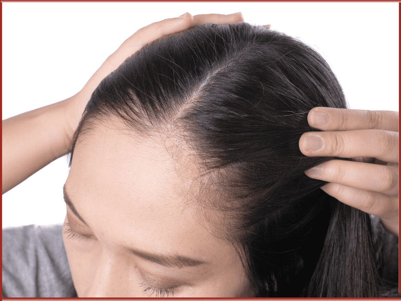 Get Instant Relief From Scalp Infections And Bald Patches With Ghee