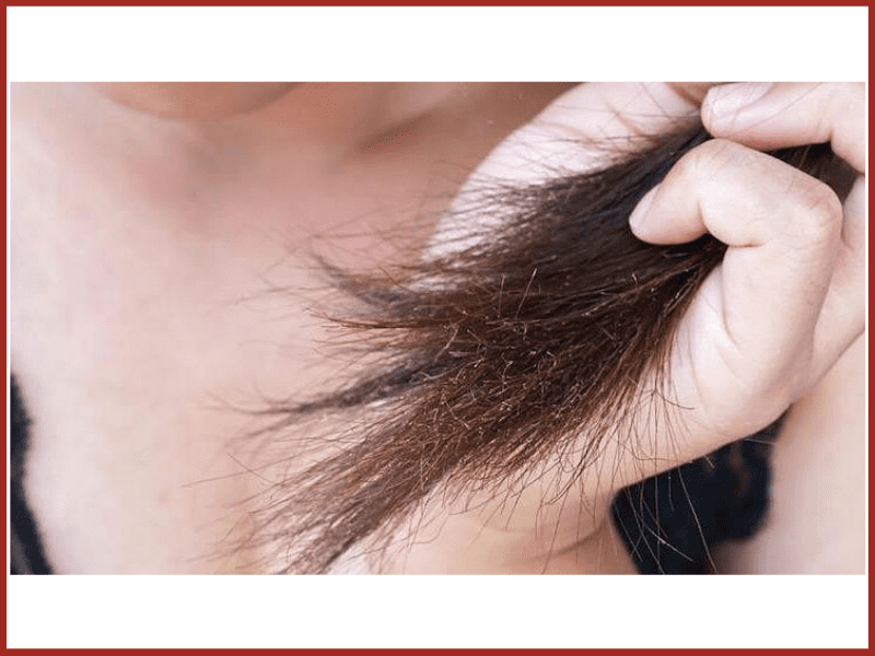 Say NO To Split Ends With Dandruff